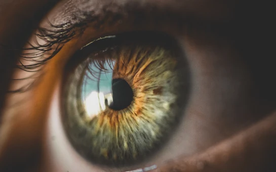 Eye Doctor Sault Ste. Marie MI Green Eye A close up photo of an eye that is orange and green.